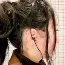 切開リフト / ボトックス（エラ・小顔） 石倉クリニック 水戸院 DAY 14 サムネイル用