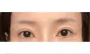 アートメイク（眉） GRACIA clinic 【グラシアクリニック】 DAY 83 サムネイル用