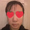 骨切り（あご） / 骨削り（エラ） リラ・クラニオフェイシャル・クリニック AFTER サムネイル用