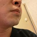 医療脱毛（顔） 自由が丘クリニック DAY 1 サムネイル用