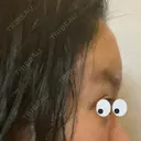 脂肪注入（肌） / 切開リフト / ボトックス（エラ・小顔） / 脂肪注入（輪郭） / ヒアルロン酸注入（額） / その他（口元） 石倉クリニック 水戸院 DAY 57 サムネイル用