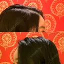 脂肪注入（肌） / 切開リフト / ボトックス（エラ・小顔） / 脂肪注入（輪郭） / ヒアルロン酸注入（額） / その他（口元） 石倉クリニック 水戸院 DAY 55 サムネイル用