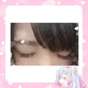 二重埋没 / 目頭切開 かめい美容クリニック宇都宮 DAY 133 サムネイル用