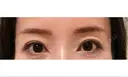 アートメイク（眉） GRACIA clinic 【グラシアクリニック】 AFTER サムネイル用