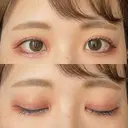 目頭切開 聖心美容クリニック 横浜院 DAY 50 サムネイル用