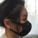 脂肪注入（肌） / 切開リフト / ボトックス（エラ・小顔） / 脂肪注入（輪郭） / ヒアルロン酸注入（額） / その他（口元） 石倉クリニック 水戸院 DAY 83 サムネイル用