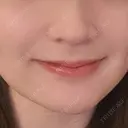 人中短縮 eクリニック 金沢本院 DAY 68 サムネイル用