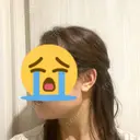 脂肪吸引（顔） ヴェルトラクリニック 大阪院 DAY 3 サムネイル用