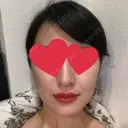 ハイフ（顔） 池袋麗歯科・美容皮膚科 DAY 2 サムネイル用
