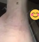 その他（肌） 湘南美容クリニック 奈良院 AFTER サムネイル用