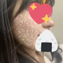 鼻尖形成（切開） / 鼻中隔延長（切開） / 軟骨移植 / その他（鼻） KAUNIS CLINIC（カウニスクリニック） DAY 36 サムネイル用