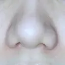 小鼻縮小（切開） ながしまクリニック DAY 28 サムネイル用