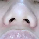 小鼻縮小（切開） ながしまクリニック DAY 28 サムネイル用