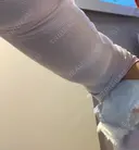 脂肪吸引（二の腕） / その他（ボディ） 銀座マイアミ美容外科 DAY 0 サムネイル用