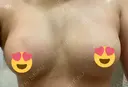 豊胸（脂肪注入） 湘南美容クリニック 新潟院 DAY 27 サムネイル用