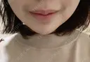 あごプロテーゼ 北尾クリニック DAY 3 サムネイル用