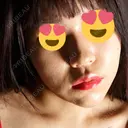 ヒアルロン酸注入（あご） TCB東京中央美容外科 池袋西口院 DAY 1 サムネイル用