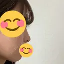 隆鼻術 / 鼻尖縮小 / ヒアルロン酸注入（鼻） 品川美容外科 福岡院 DAY 14 サムネイル用