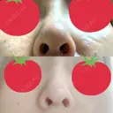 隆鼻術 / 鼻中隔延長（切開） / 軟骨移植 / 鼻尖縮小 しらさぎ形成クリニック 徳島院 DAY 31 サムネイル用