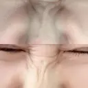 シワ取りボトックス 湘南美容クリニック 藤沢院 DAY 9 サムネイル用