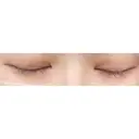 二重切開 / 目頭切開 東京イセアクリニック DAY 157 サムネイル用