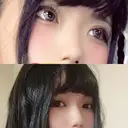 ヒアルロン酸注入（鼻） TCB東京中央美容外科 福島院 DAY 7 サムネイル用