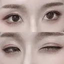 二重切開 松下皮フ形成外科 DAY 93 サムネイル用