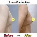 豊胸（脂肪注入） Mods Clinic（モッズクリニック） 東京院 AFTER サムネイル用
