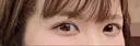 ヒアルロン酸注入（涙袋） アクトリー勝どきウェルネスメディカルクリニック AFTER サムネイル用