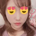 スレッドノーズ / ヒアルロン酸注入（鼻） / 脂肪溶解注射（顔） / その他（鼻） TCB東京中央美容外科 池袋西口院 AFTER サムネイル用