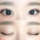 二重埋没 湘南美容クリニック 松山院 DAY 63 サムネイル用
