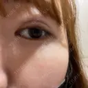 二重埋没 AiZ CLINIC DAY 1 サムネイル用