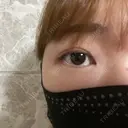 二重埋没 AiZ CLINIC DAY 5 サムネイル用