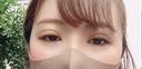 二重埋没 湘南美容クリニック 渋谷院 DAY 1 サムネイル用