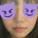 鼻尖形成（切開） / ヒアルロン酸注入（鼻） / ヒアルロン酸注入（あご） 東京ヒルズクリニック 新宿院 DAY 0 サムネイル用