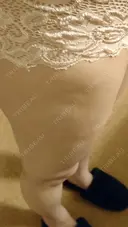 脂肪吸引（脚） ドクターフィット（Dr.fit）クリニック DAY 80 サムネイル用