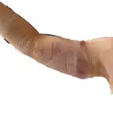 脂肪吸引（二の腕） / 豊胸（脂肪注入） 銀座マイアミ美容外科 DAY 1 サムネイル用