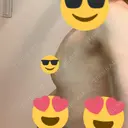 脂肪吸引（二の腕） / 豊胸（脂肪注入） 銀座マイアミ美容外科 DAY 16 サムネイル用