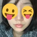 鼻尖形成（切開） / ヒアルロン酸注入（鼻） / ヒアルロン酸注入（あご） 東京ヒルズクリニック 新宿院 AFTER サムネイル用