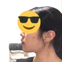 骨切り（あご） / 脂肪吸引（顔） 銀座マイアミ美容外科 DAY 102 サムネイル用