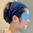 糸リフト / 脂肪吸引（顔） 銀座マイアミ美容外科 DAY 181 サムネイル用