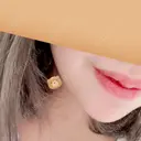 あごプロテーゼ 北尾クリニック DAY 91 サムネイル用
