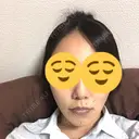 骨切り（あご） / 脂肪吸引（顔） 銀座マイアミ美容外科 DAY 116 サムネイル用