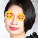 隆鼻術 / 鼻尖形成（切開） / 鼻中隔延長（切開） / 骨切幅寄せ 表参道スキンクリニック 表参道院 DAY 118 サムネイル用