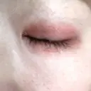 二重埋没 AiZ CLINIC DAY 60 サムネイル用