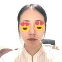 骨切り（あご） / 脂肪吸引（顔） 銀座マイアミ美容外科 DAY 129 サムネイル用