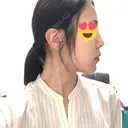 骨切り（あご） / 脂肪吸引（顔） 銀座マイアミ美容外科 DAY 129 サムネイル用