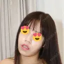 糸リフト ルラ美容クリニック 渋谷本院 DAY 4 サムネイル用