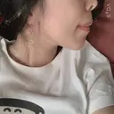 ガミースマイル手術 / 矯正（ワイヤー） / セラミック / ホワイトニング ラ・ブージュデンタルクリニック DAY 433 サムネイル用