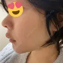 セットバック 大塚美容形成外科・歯科 大塚本院 DAY 36 サムネイル用